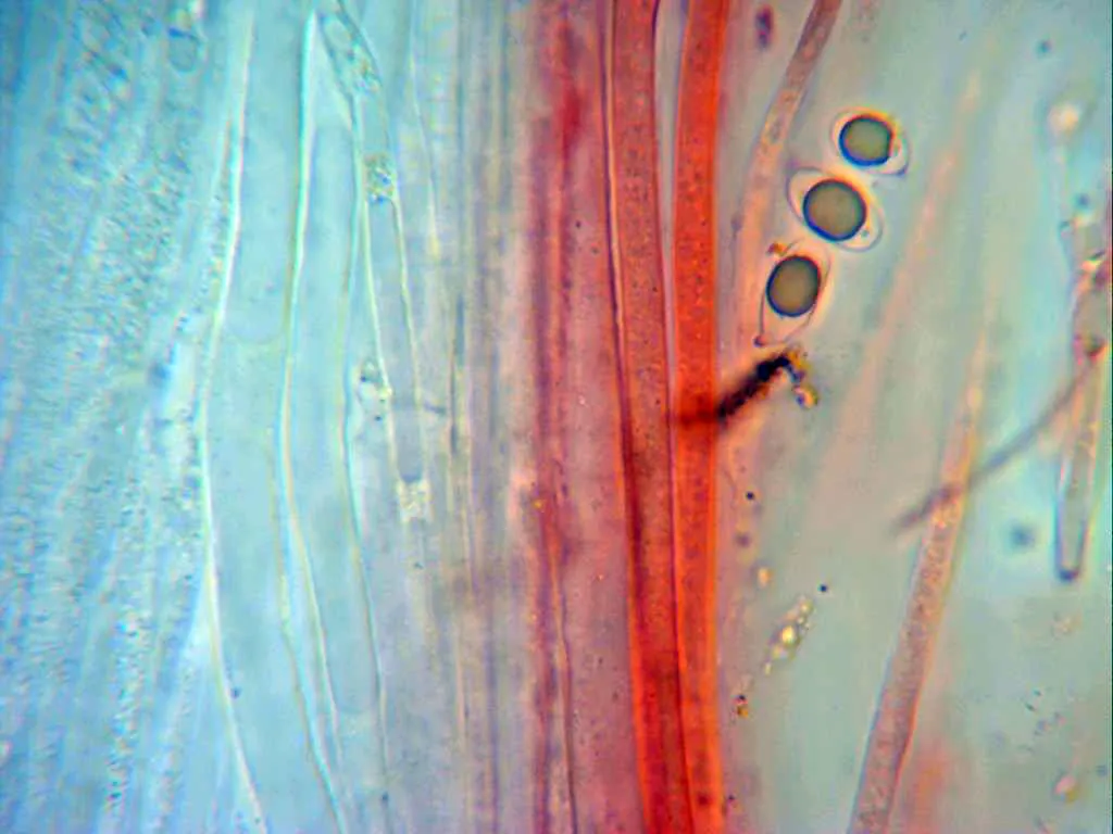 Microscopía de Mycena viridimarginata - 10 - Suprapellis pié x 1000 sin caulos